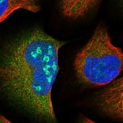 RABGAP1L Antibody, Novus Biologicals 25 &mu;L, Unlabeled:Antibodies, Polyclonal